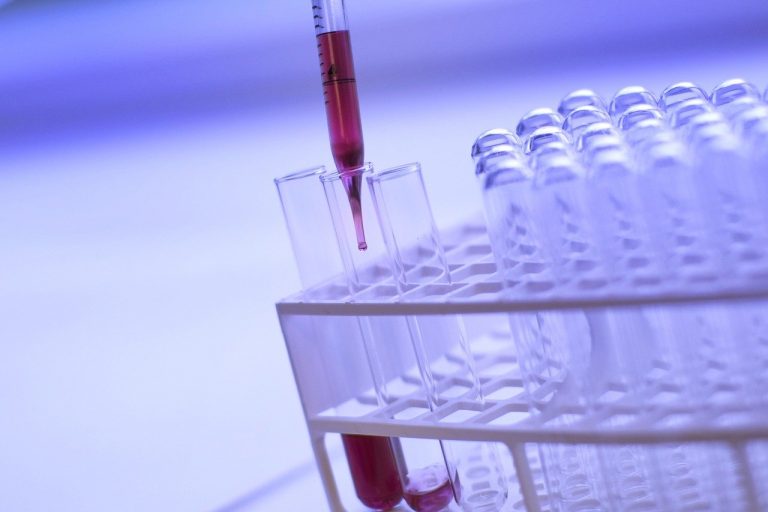 coronavirus plasma iperimmune da guariti