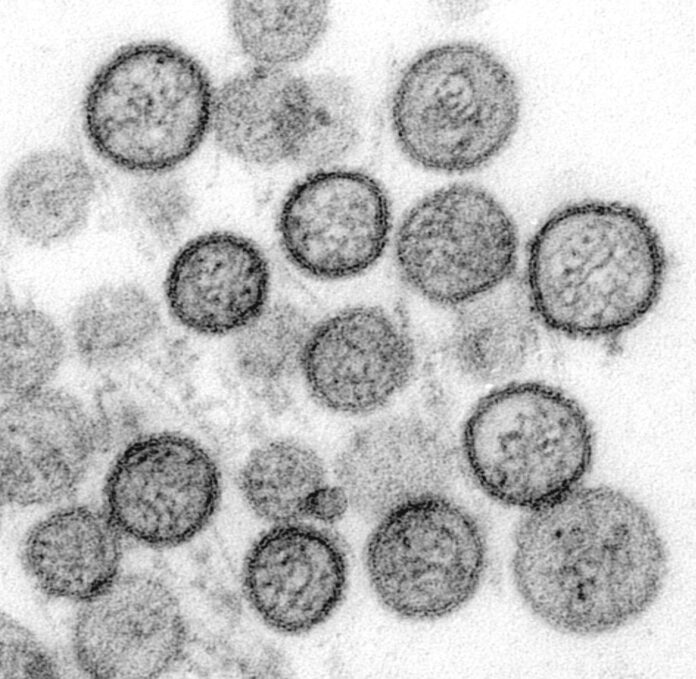 hantavirus