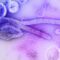 Ebola Bundibugyo, al via il primo studio clinico su possibili terapie