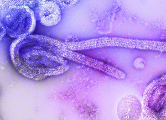 ebola