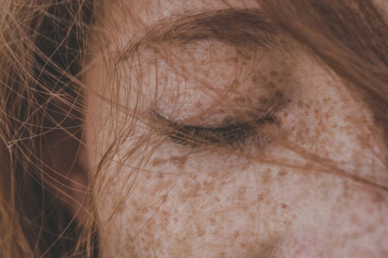 Un vaccino anticancro su misura riduce il rischio di recidiva del melanoma
